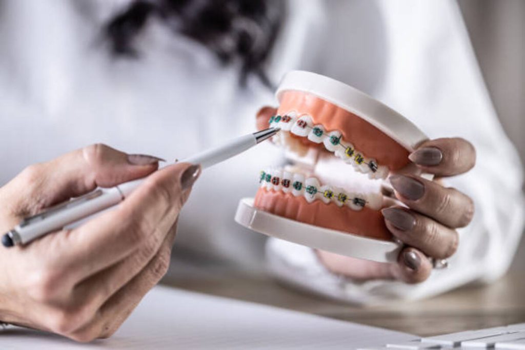 dental implants in Los Gatos CA
