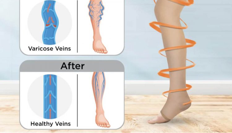 Choosing the Right Above Knee Stockings